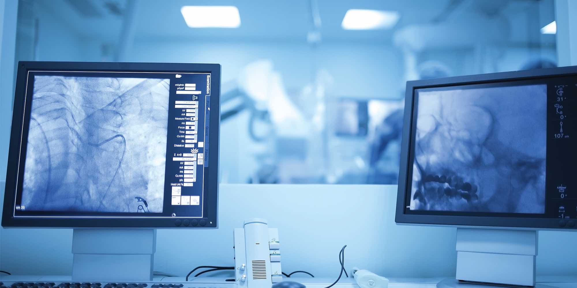 Pulmonary Function Testing