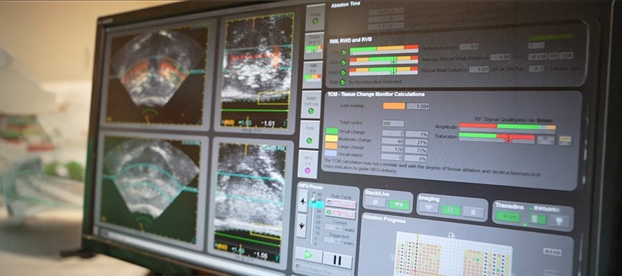 Treating prostate cancer with ultrasound waves 