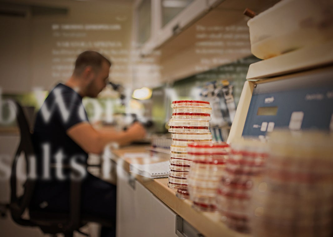 Sample containers on a lab desk; St. Peter's medical technician in blue scrubs looking through microscope in the background.