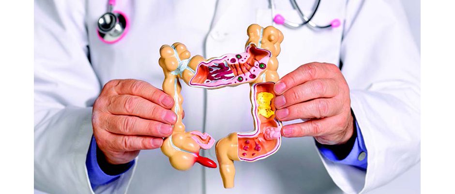 Colorectal screening 2024