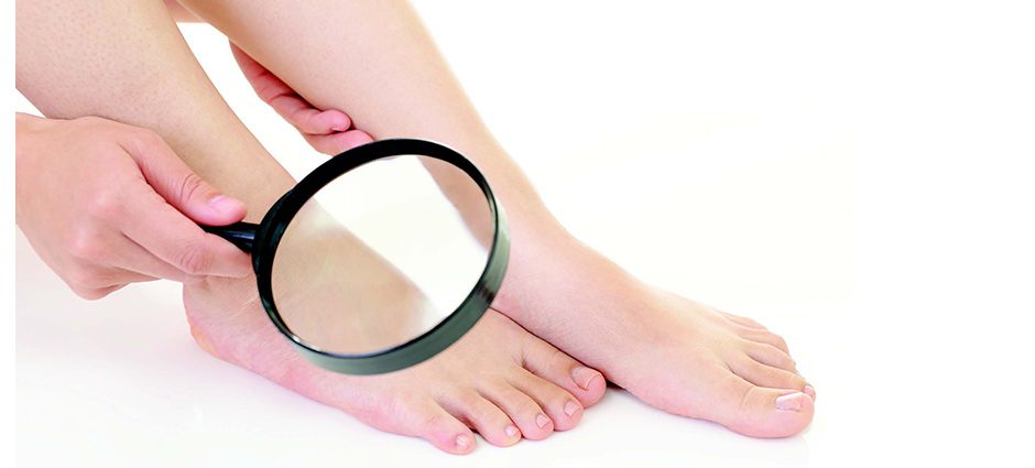 diabetes - wound care starts with your feet