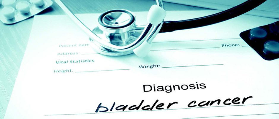 diagnosis bladder cancer