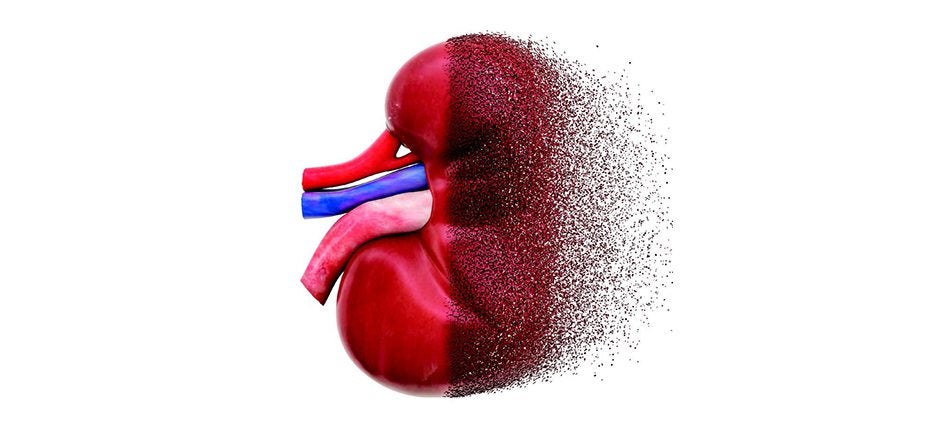 National Kidney Month (Cerda)