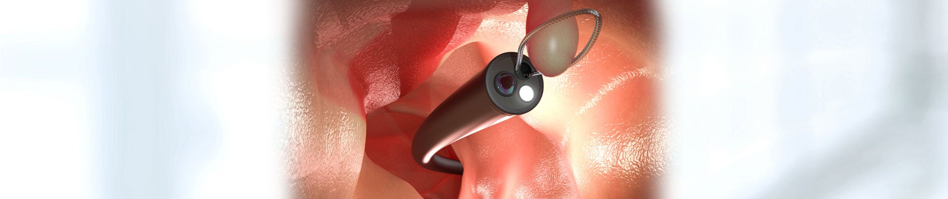 Endoscopy Services Banner